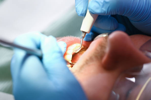 Best Emergency Dental Care for Trauma or Injury in Forks, WA