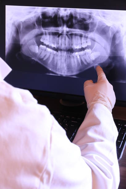 Best Emergency Tooth Extraction in Forks, WA