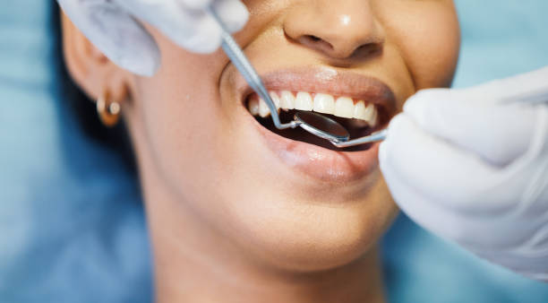 Best Emergency Broken Tooth Repair in Forks, WA