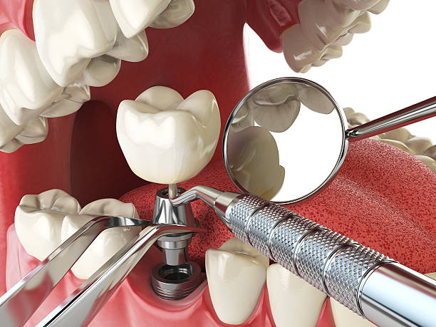Best Weekend Emergency Dentist in Forks, WA